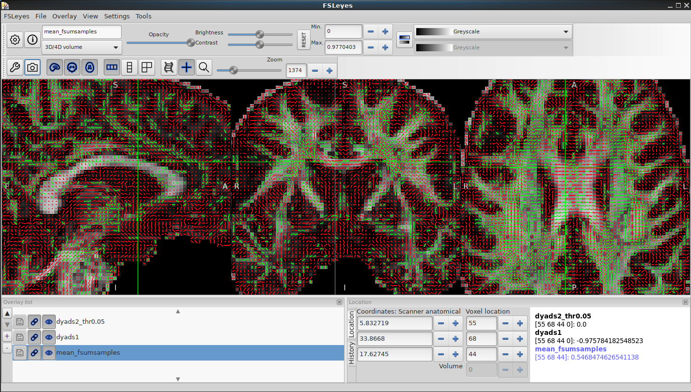 Fsl Software FMRIB Software Library (FSL) - Revolutionising brain imaging | Oxford ...