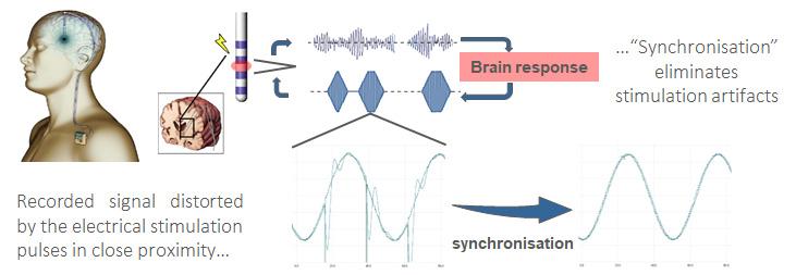 Simultaneous stimulation and artefact-free recording for ...