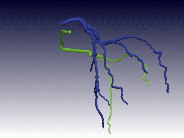 A new method for automated 3D blood vessel reconstruction | Oxford ...