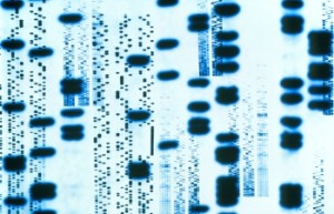 Autoradiogram_DNA