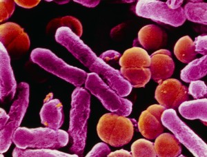 coloured micrograph of E. coli and Streptococcal bacteria