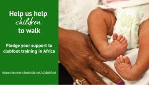 Image from How you can help eradicate clubfoot in children News Article