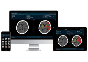 Image from Strokes targeted in new Brainomix collaboration News Article