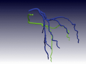 Image from Licence Details: A new method for automated 3D blood vessel reconstruction