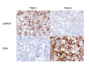 Image from Licence Details: Rapid, cost-effective test for T cell lymphoma and leukaemia