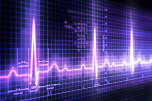 Image from Licence Details: An automated deep learning system for ECG classification