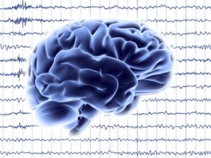 Image from Licence Details: Realtime phase tracking and manipulation of neuronal oscillations