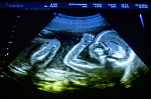 Image from Licence Details: Deep learning ultrasound device to estimate the gestational age of a fetus during pregnancy