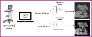 Image from Licence Details: A self learning algorithm to optimise digital pulse sequences for ultrasound devices