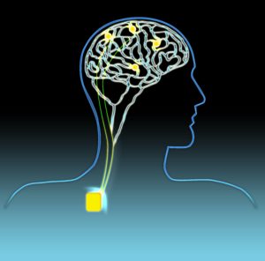 Image from Licence Details: Delivering closed-loop deep brain stimulation using multiple electrodes