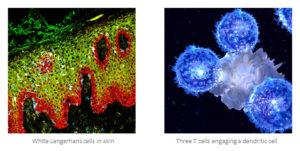 Image from Licence Details: Anti-CD1a antibodies for therapeutic application in inflammation, oncology and other diseases