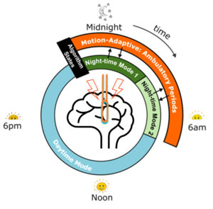 Image from Licence Details: Closed-loop deep brain stimulation to influence sleep state