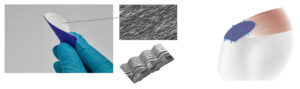 Image from Licence Details: BioPatch – a bio-instructive resorbable implant for enhancing surgical repair of rotator cuff tendon